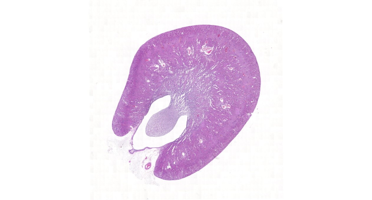 癌症研究_09.jpg