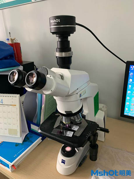 明美显微镜相机MS60应用于病理切片检验2.jpg